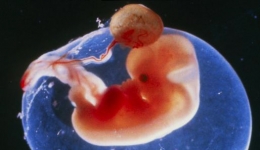 妊娠15周的孕妇须做心脏手术，孕妇和胎儿安全是一场生死考验……