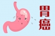 中国人群胃癌风险管理公众指南(2023版)摘要